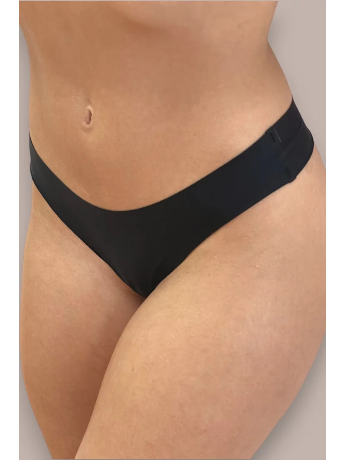 ΣΕΤ 3ΤΜΧ STRING ΓΥΝ. LASER CUT   90% ΠΟΛΥΑΜΙΝΤ 10% ΕΛΑΣΤΑΝ
