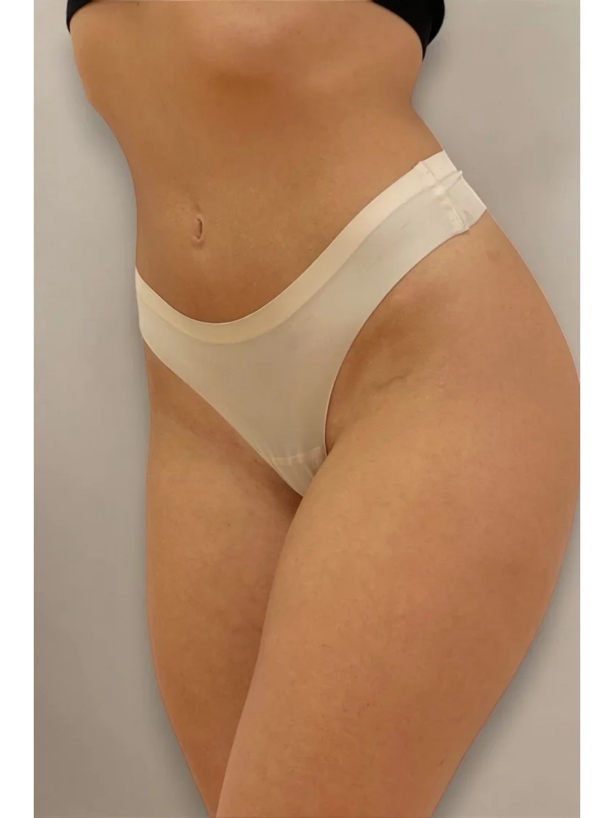 ΣΕΤ 3ΤΜΧ STRING ΓΥΝ. LASER CUT   90% ΠΟΛΥΑΜΙΝΤ 10% ΕΛΑΣΤΑΝ